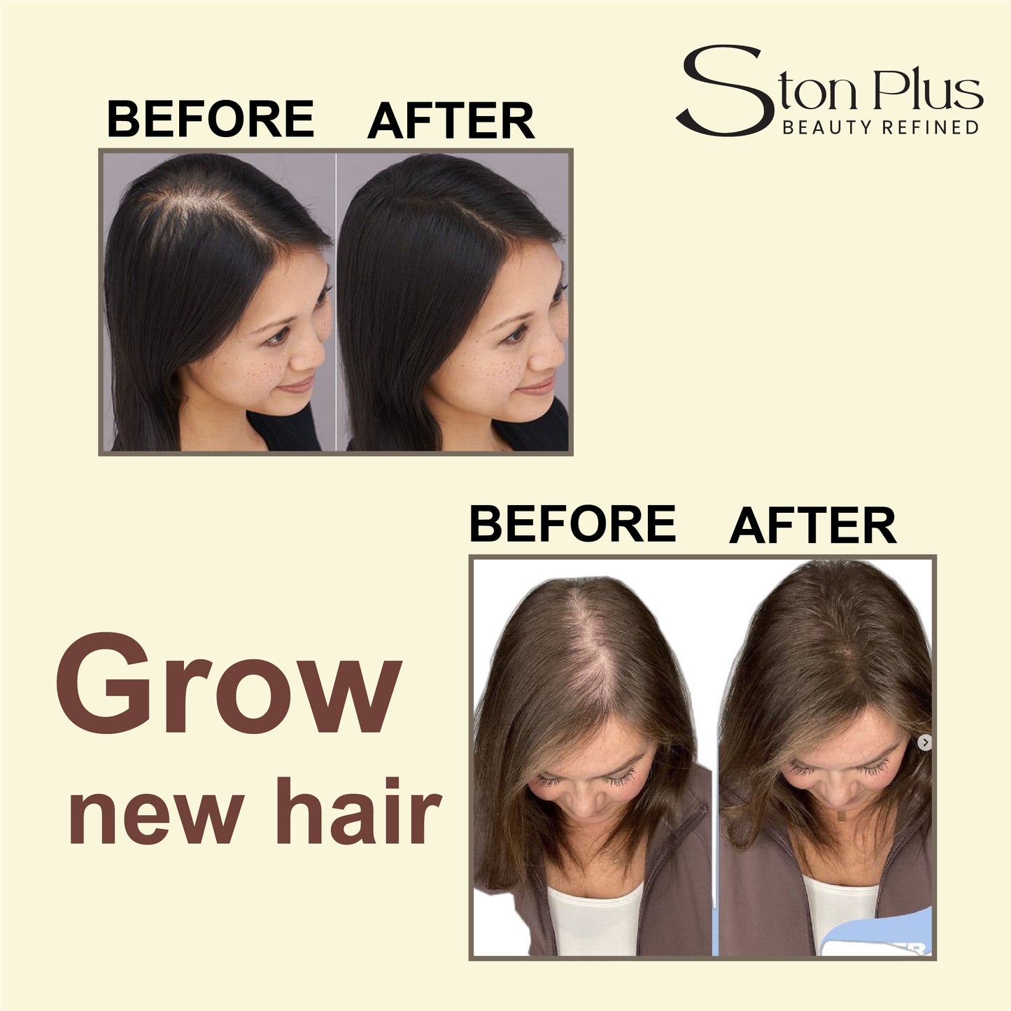 Ston Plus Hair Growth Oil – Non-Sticky, Enriched with Bhringraj & Almond Oil (100ml)
